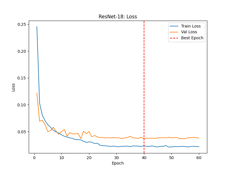 ResNet-18_loss.png